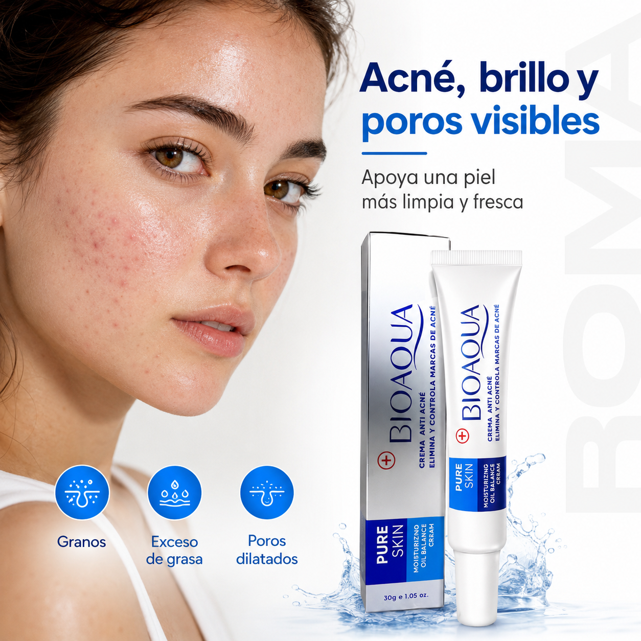 CREMA ANTI ACNÉ BIOAQUA 30G