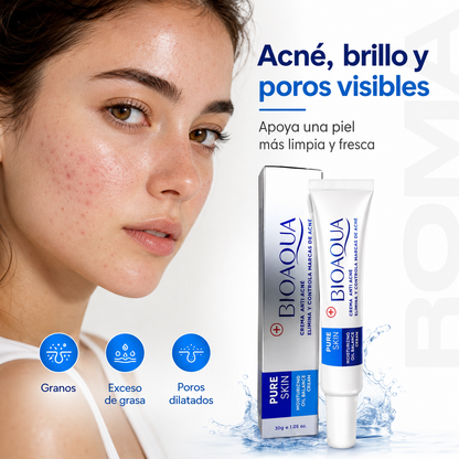 CREMA ANTI ACNÉ BIOAQUA 30G