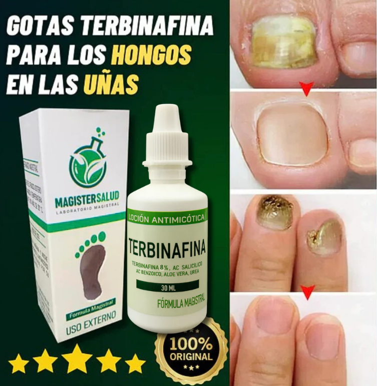 TERBINAFINA GOTAS ANTIFÚNGICAS
