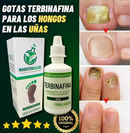 TERBINAFINA GOTAS ANTIFÚNGICAS